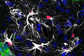 Un compuesto del cardo frena la metástasis cerebral.