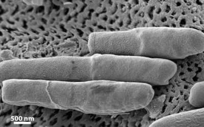 El azúcar añadido en los alimentos aumenta la virulencia de las superbacterias.