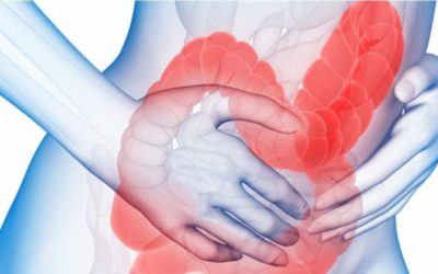 Hallan relación entre la enfermedad inflamatoria intestinal y la depresión.