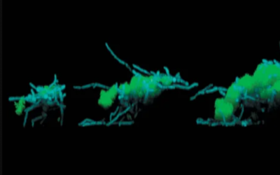 Descubren cómo los hongos y las bacterias caminan por la superficie de nuestros dientes.