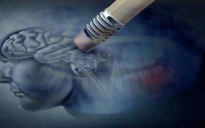 Nuevos estudios podrían confirmar que el Alzheimer se relacionaría con una bacteria dental.