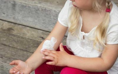 ¿Cómo influye la microbiota en el desarrollo del eczema y la alergia alimentaria?