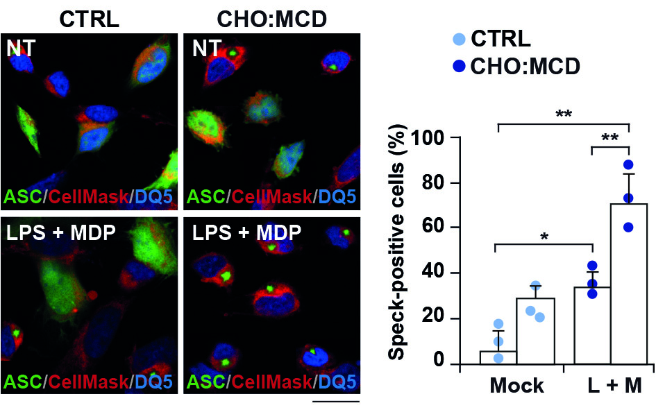 IDENTIFICAN AL COLESTEROL COMO REGULADOR DEL PROCESO INFLAMATORIO EN LA ENFERMEDAD DE ALZHEIMER.