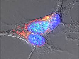 Investigadoras del CSIC descubren la presencia de amiloides en la microbiota intestinal asociados con la enfermedad de Parkinson.